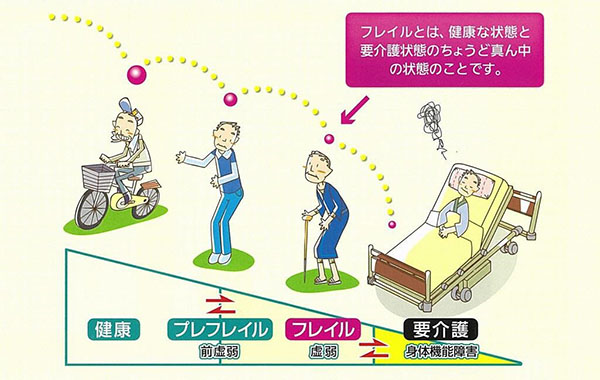 フレイル説明／フレイルとは、健康な状態と要介護状態のちょうど真ん中の状態のことです