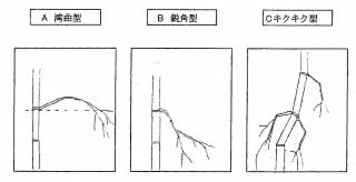 逆ダケのいろいろ