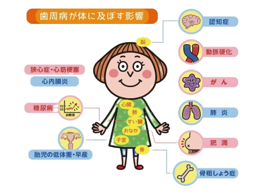 歯周病がからだに及ぼす影響の図