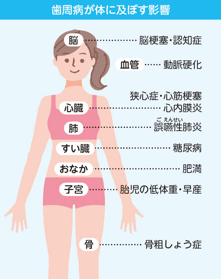 歯周病が体に及ぼす影響